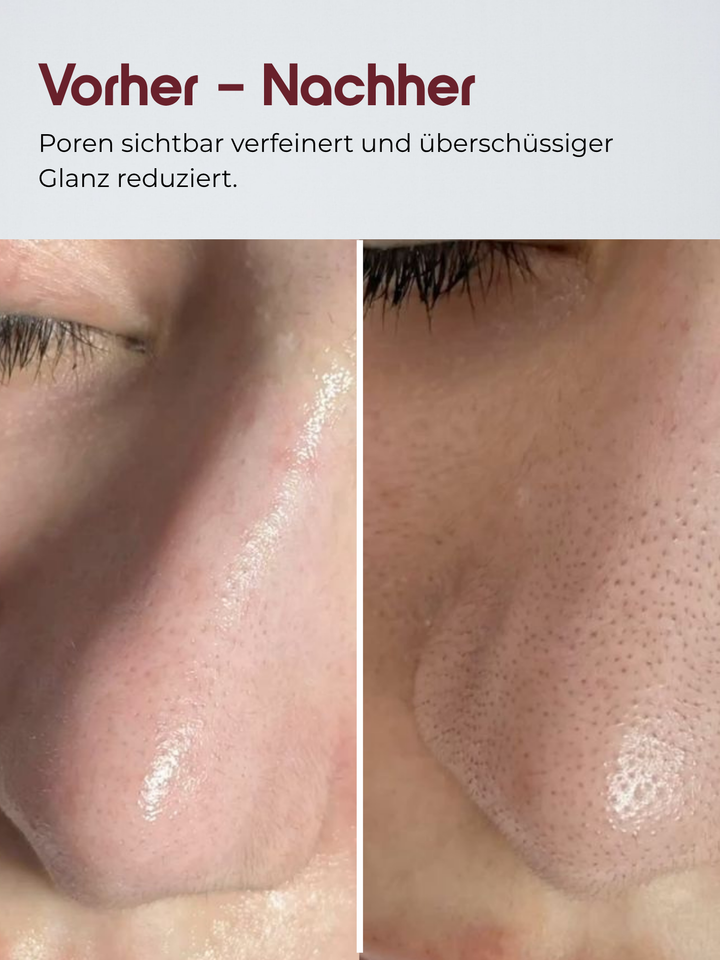 Reis Peeling Glow-Serum