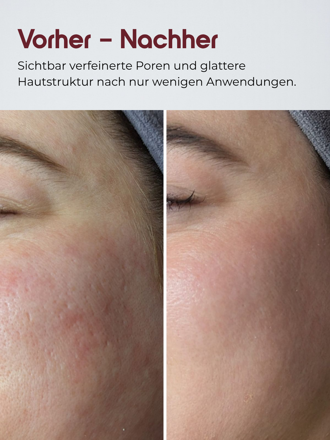 Reis Peeling Glow-Serum