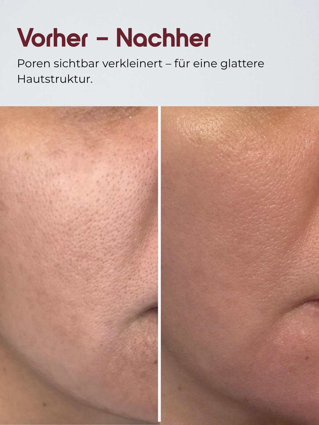 Reis Peeling Glow-Serum